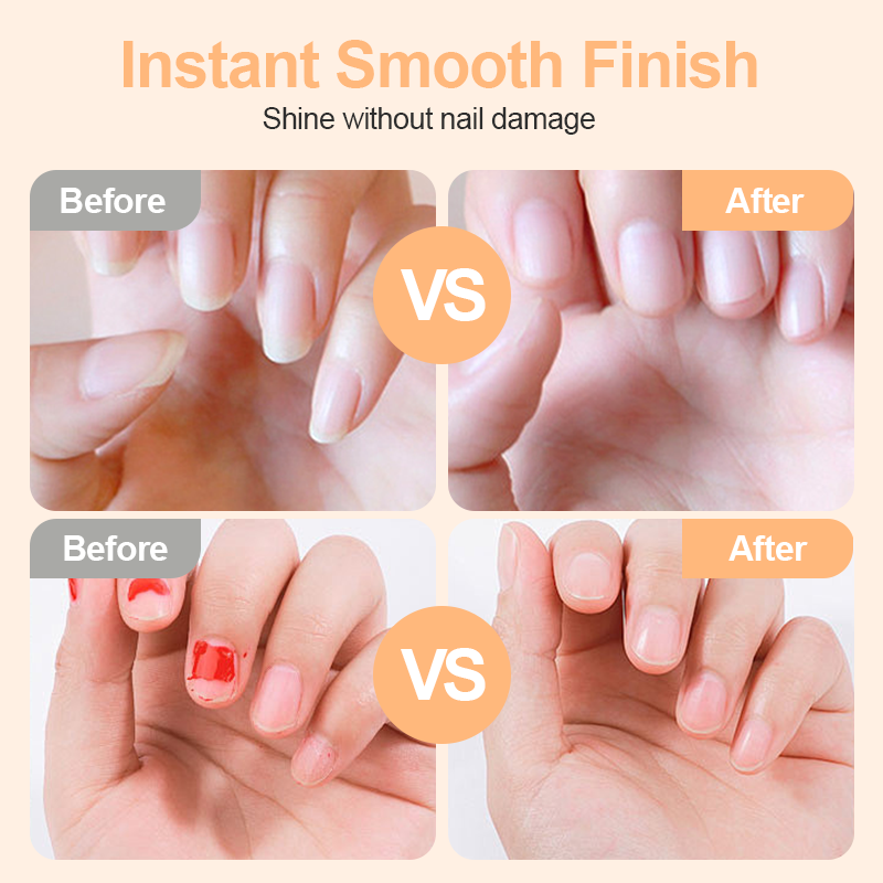 Before and after nail trim results